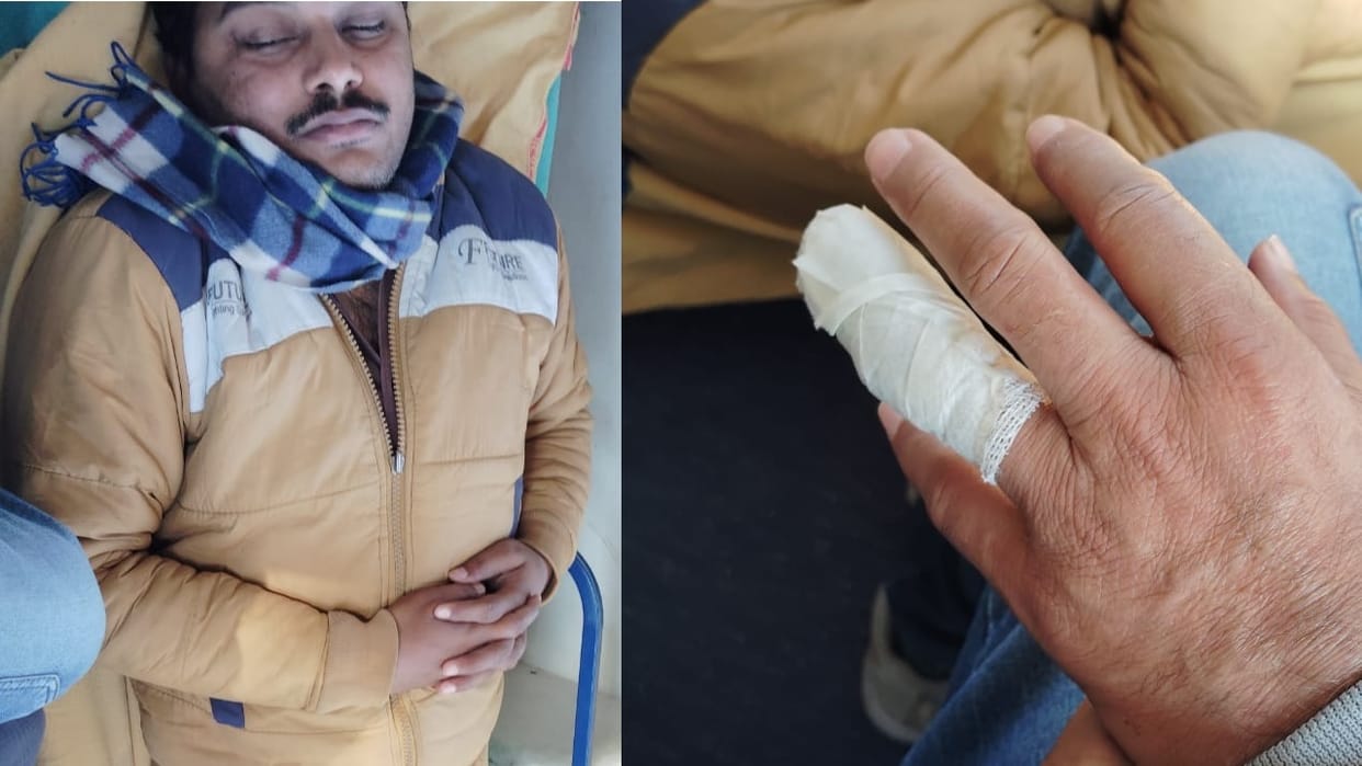 JE and area incharge injured in Ambala, Team that went to catch electricity theft attacked