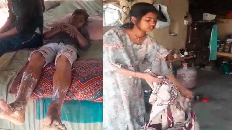 Fire broke out due to leakage in LPG regulator in Barabanki five people  got burnt including mother-daughter