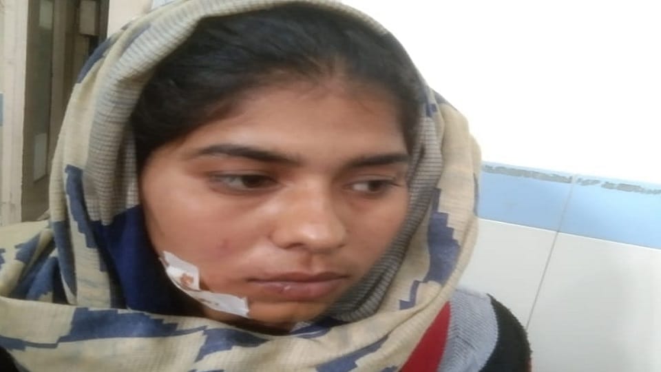 Leopard attack on girl cutting grass in ramnagar