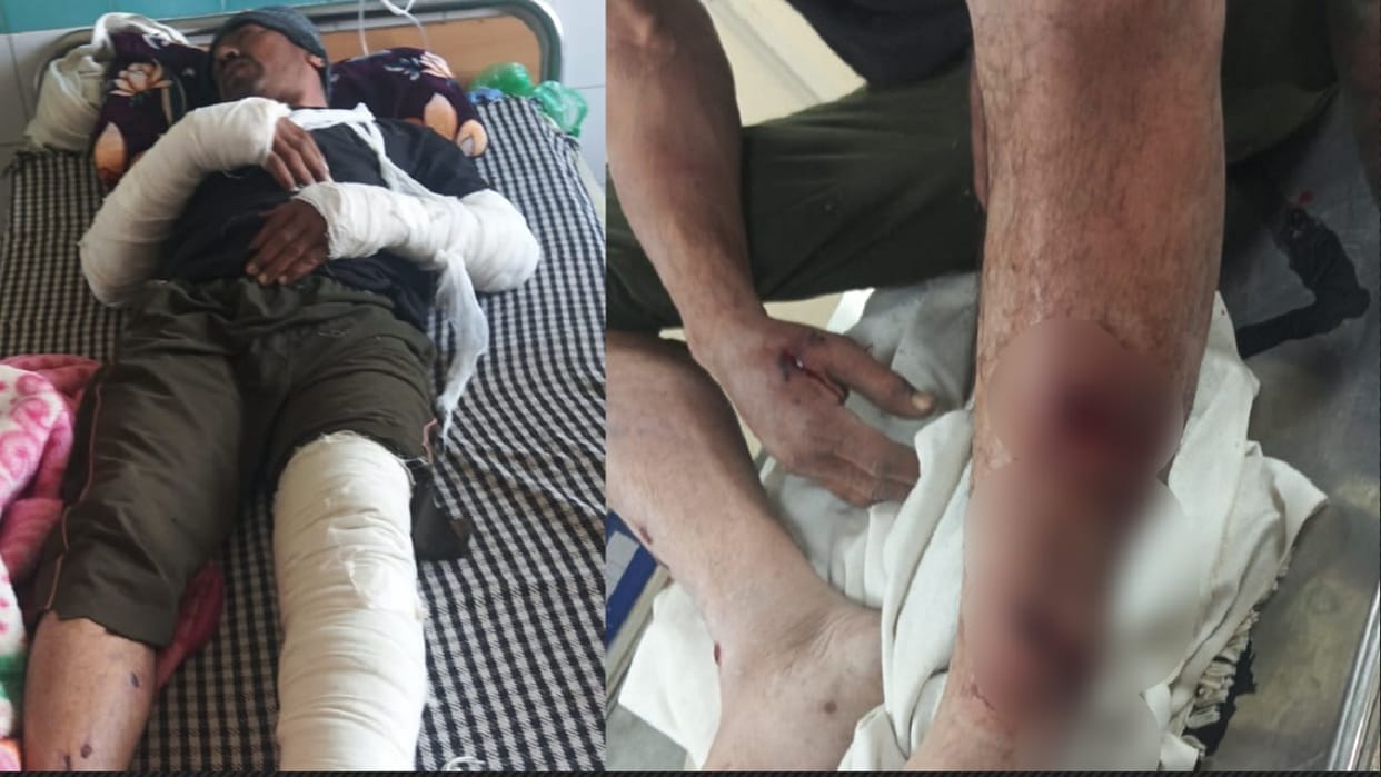 Friend father kidnapped at gunpoint, hands and legs were broken and left half dead In Panipat