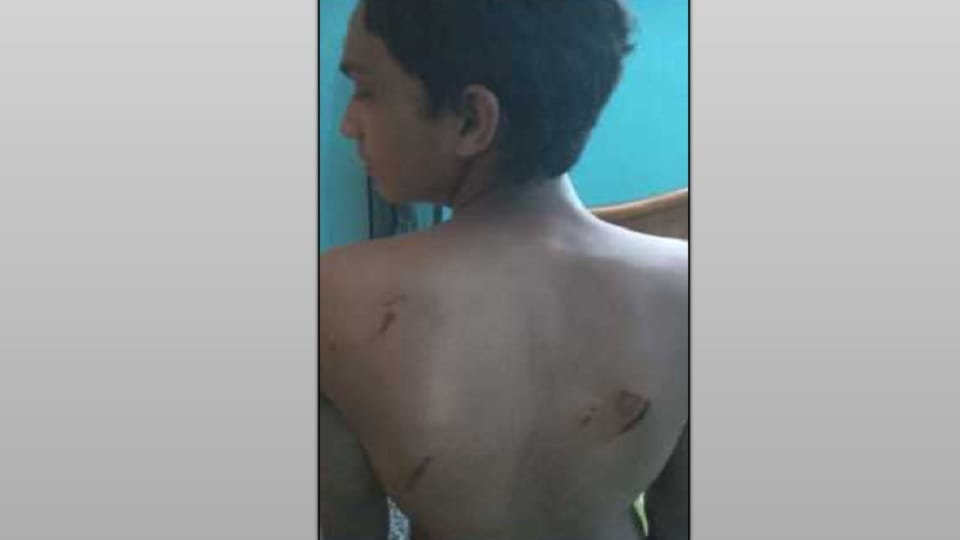 Meerut: A group of dogs attacked a student returning from school, threw him off his scooter and bit him