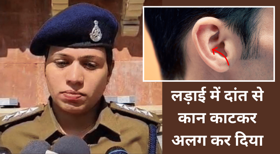 Indore News Man Bites Ear crime case