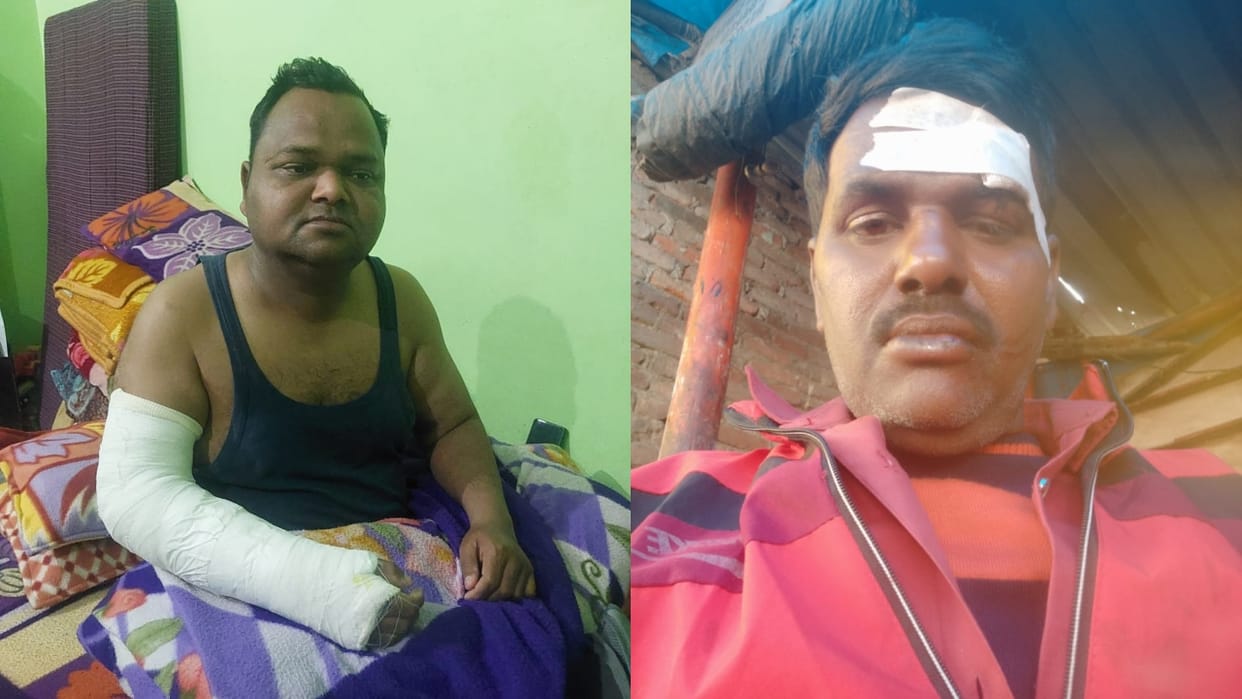 car of devotees returning from Mahakumbh collided with tree six injured in pilibhit