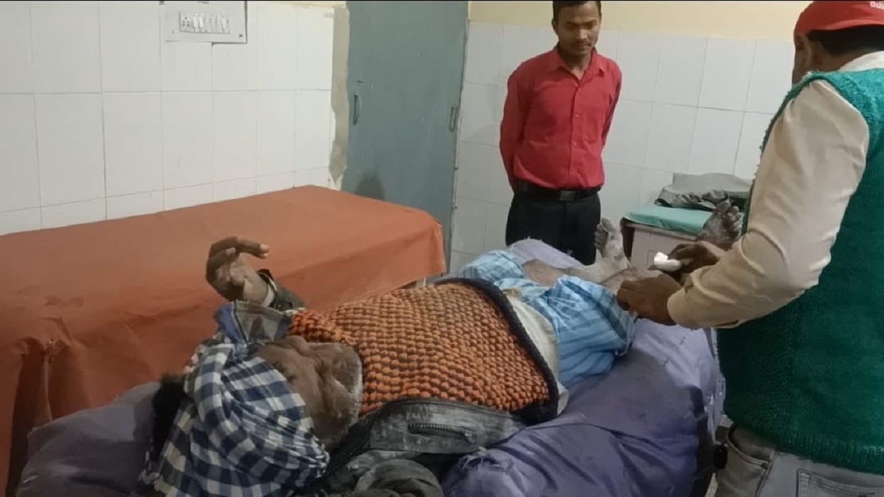 Three people including balloon seller injured in cylinder explosion in Shahjahanpur