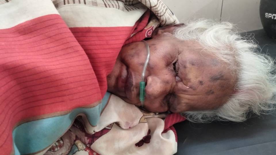 bees attacked an old lady In Bahraich villagers rushed to her rescue after hearing her scream