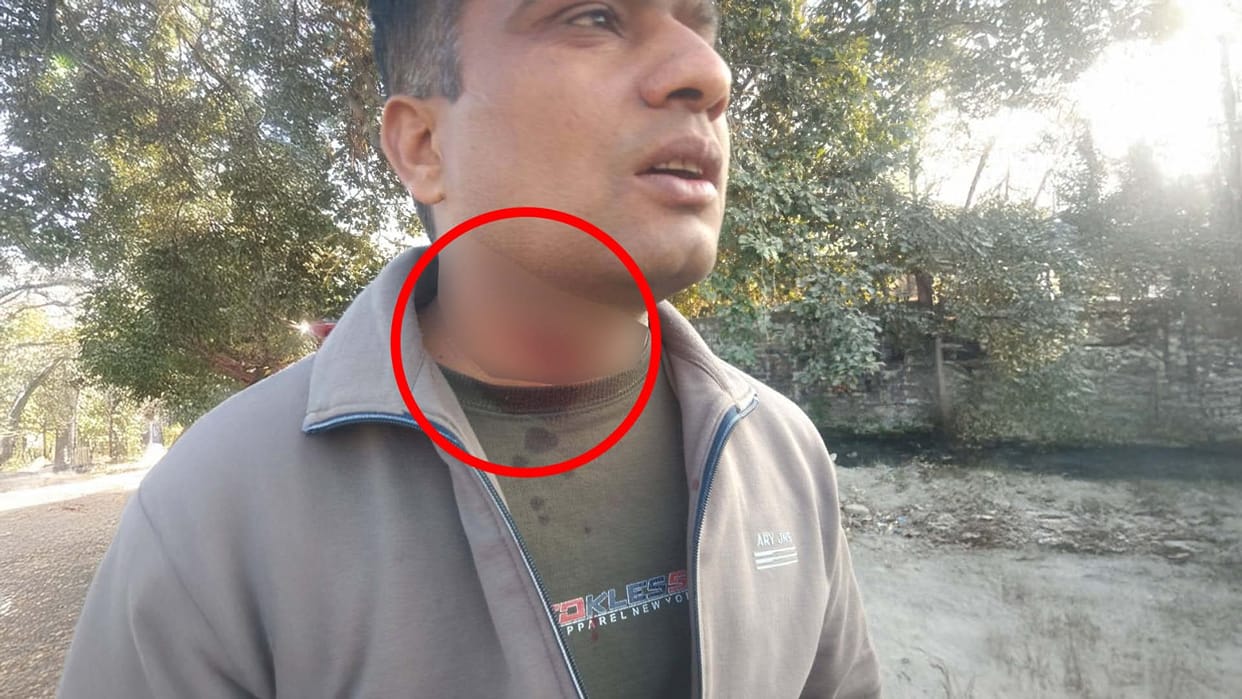 constable injured after being hit by Chinese tractor in shahjahanpur