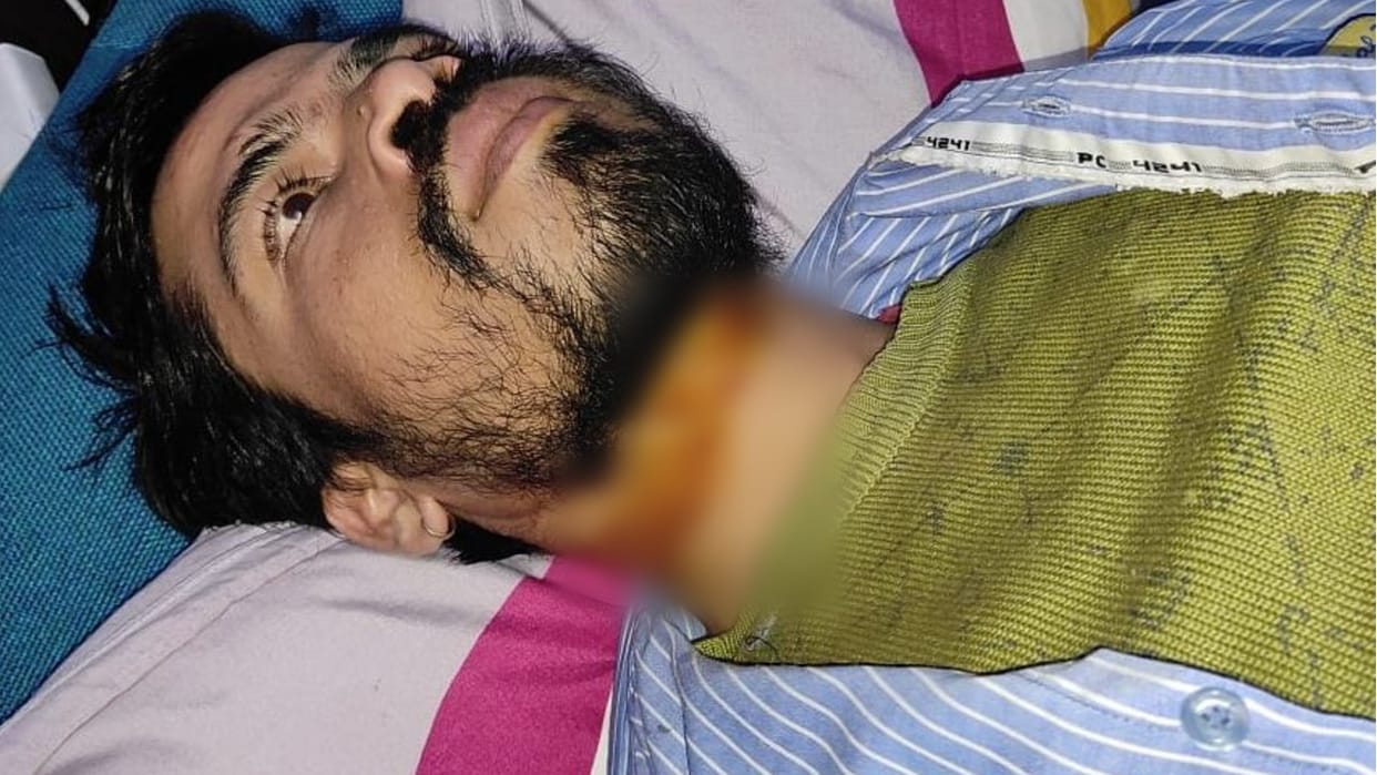 neck of man cut by Chinese manjha his condition is critical in lakhimpur kheri