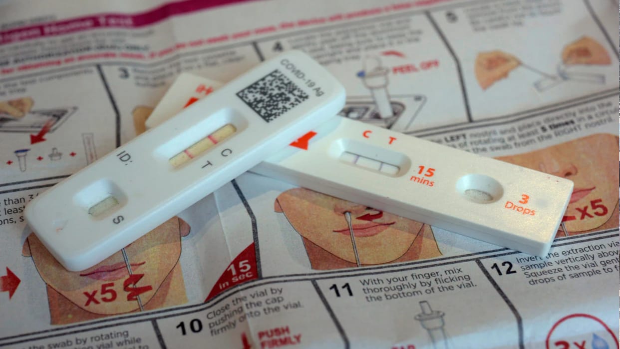 TB testing done for the first time in the fair with AI based X hand held machine, 19 patients identified in 10