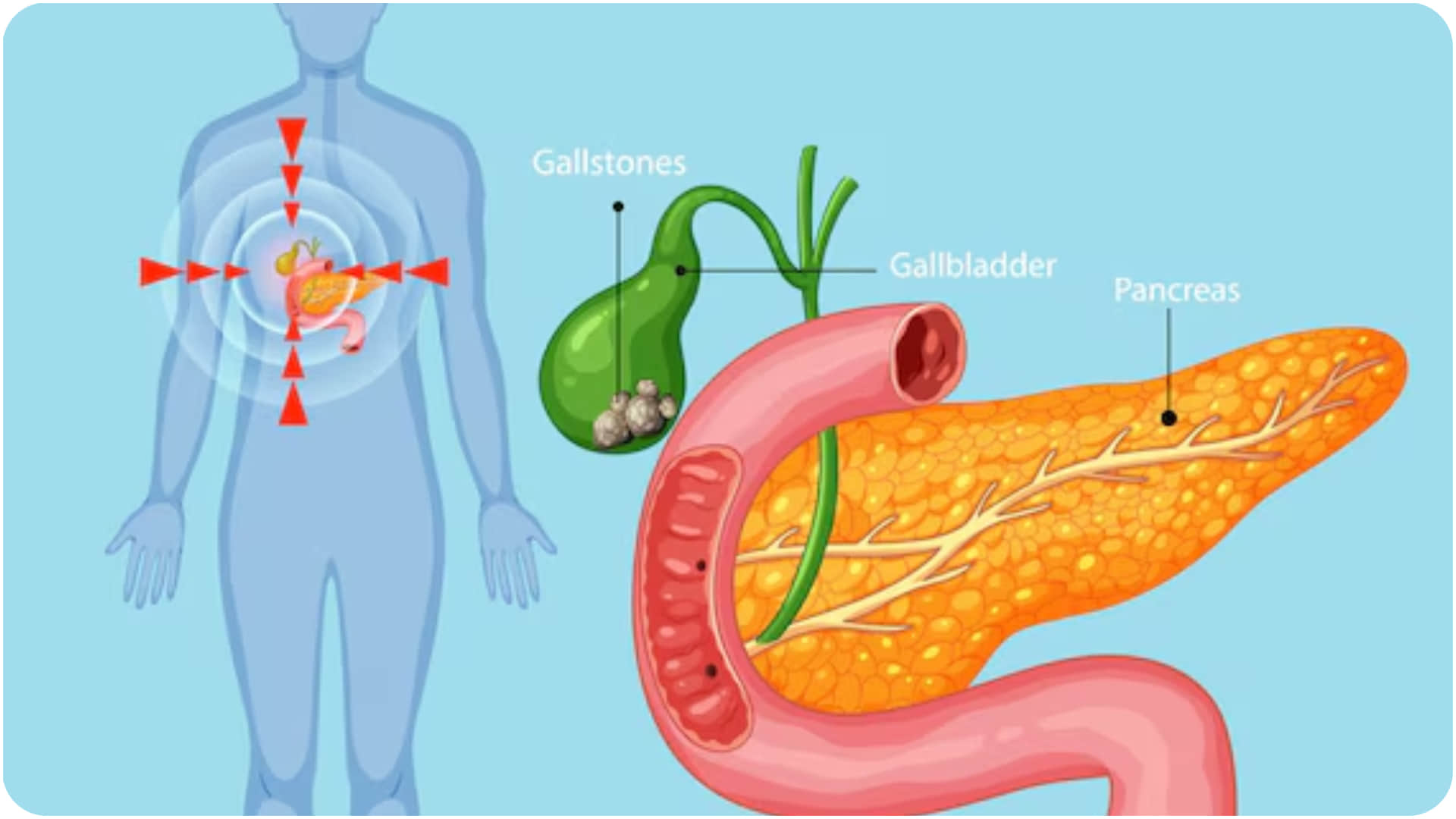 how gallbladder stones occurs know gallbladder stone hone ke karan aur lakshan in hindi