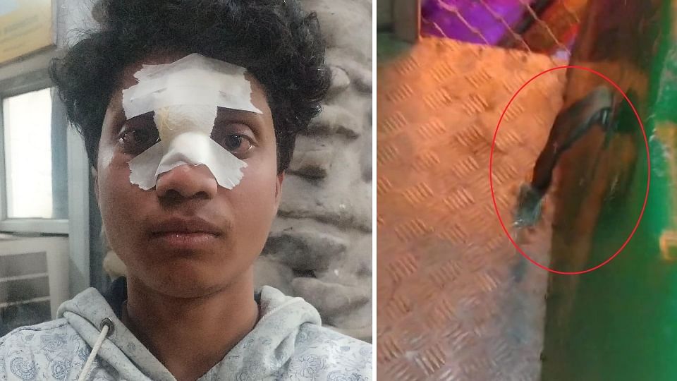Seat belt of swing broke in Leisure Valley chandigarh Young man injured