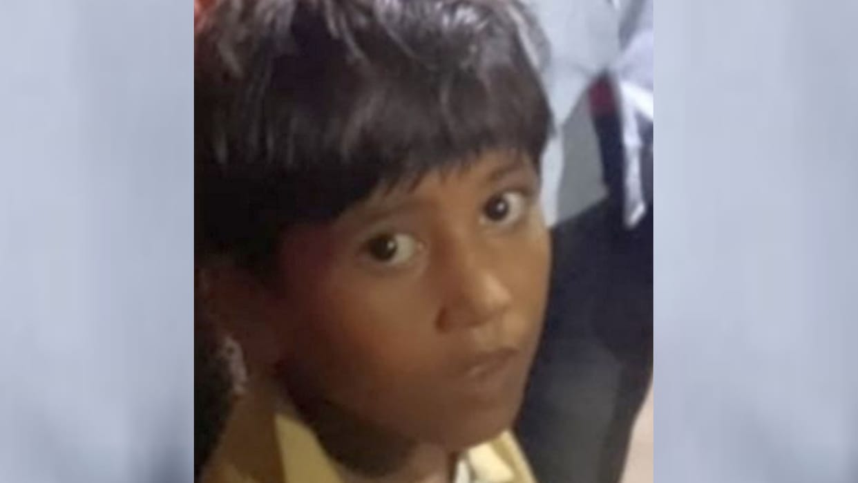 Seven year old girl bitten by dogs, dies due to windpipe cut