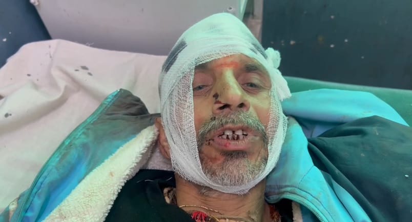 Shopkeeper attacked with axe and sickle FIR filed against five people on the complaint of the injured