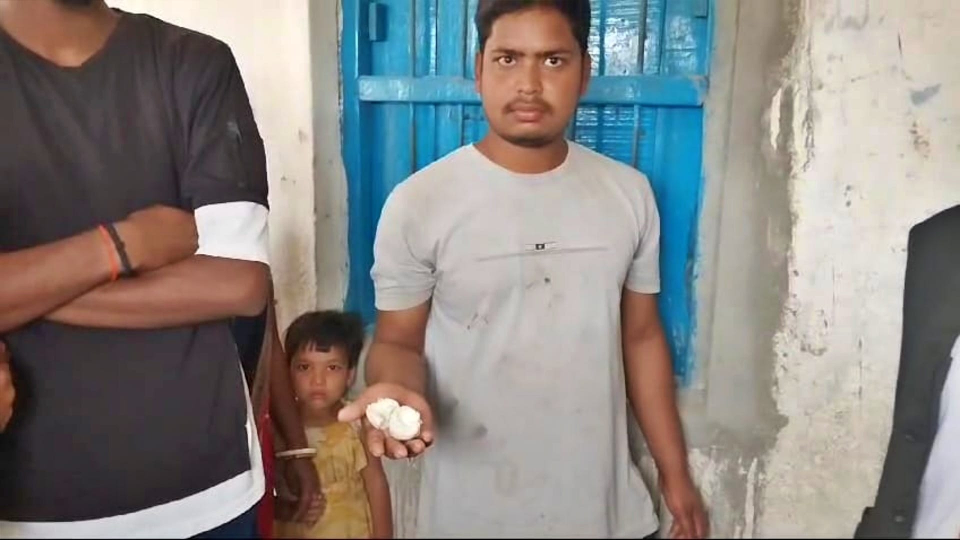 Nalanda News: 80 children fall ill after eating egg and rice in mid-day meal, admitted to hospital