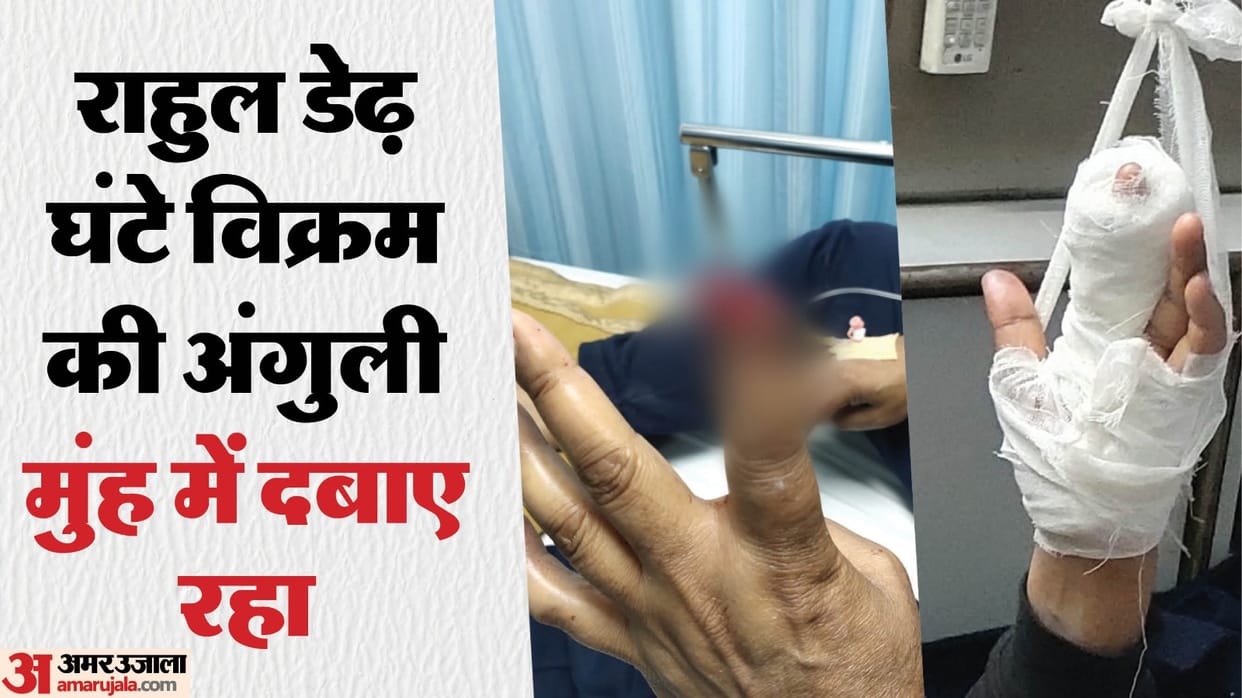 In a fight man bit off neighbor finger with his teeth in faridabad