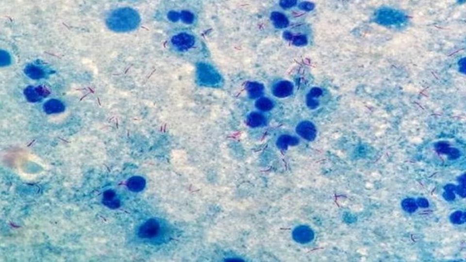 WHO says four year old child died of Ebola in Uganda