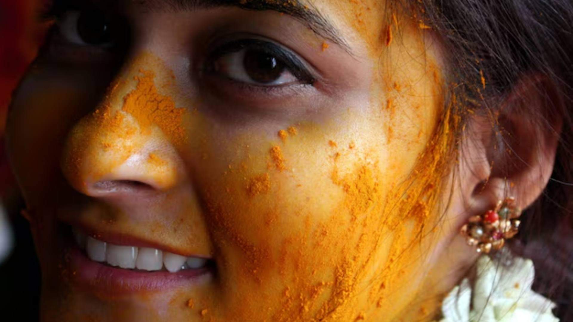 Mosquito Bites Remedies Get Instant Relief with These Home Remedies