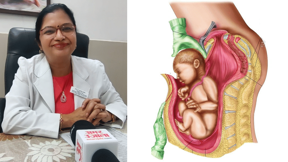 Indore News Rising Cesarean Delivery Rates Raise Concerns, Normal Births Declining
