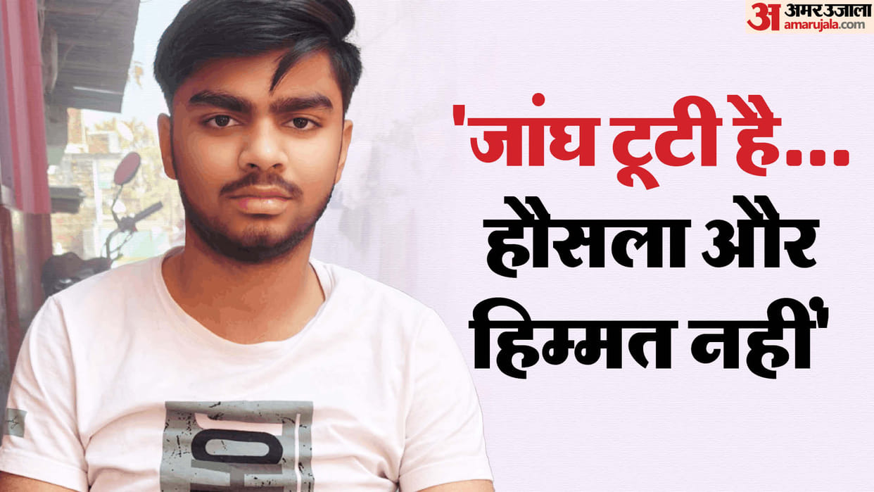 Krish is giving 10th class exam even after breaking his thigh