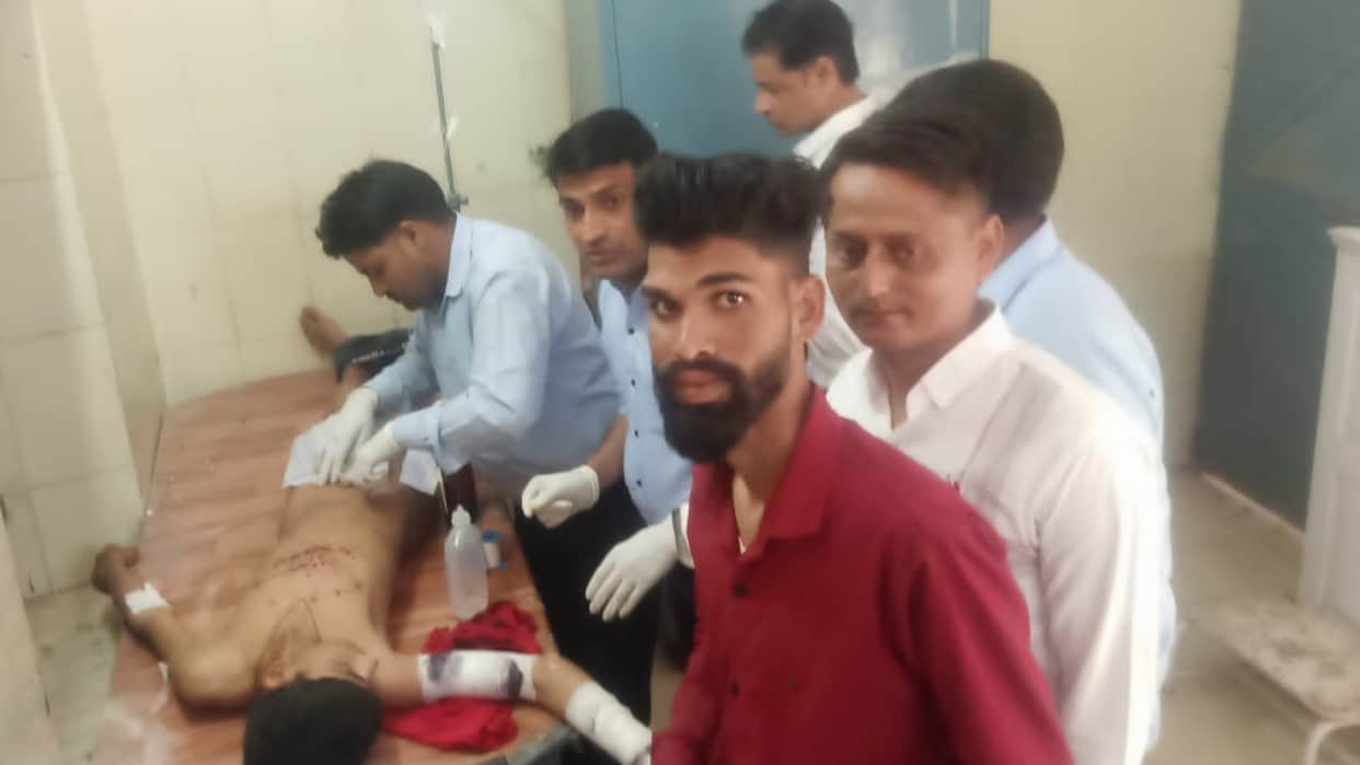 Nagaur News: Major accident due to mobile battery blast, 14-year-old boy seriously injured, panic in the area