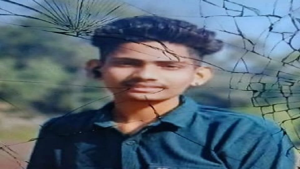 man with more than 96 percent burn injuries dies under suspicious circumstances in kashipur
