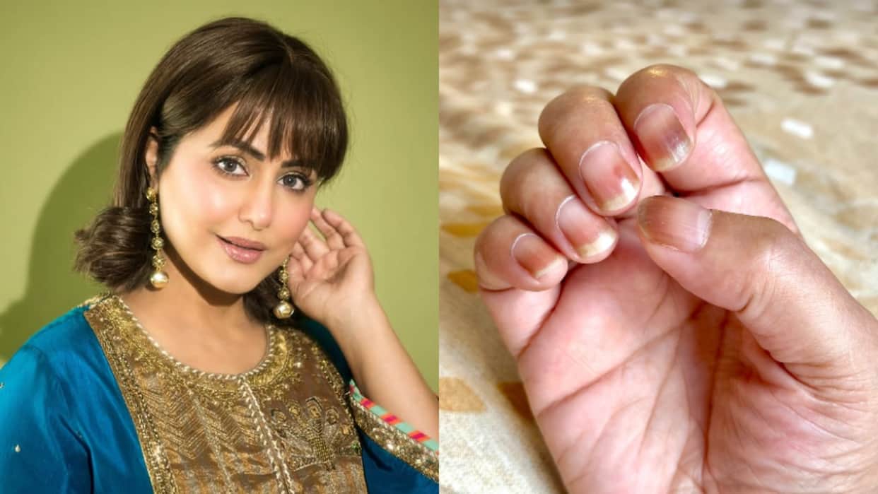 Hina Khan Talks about her discoloration nails during Breast Cancer treatment says its effects of chemotherapy