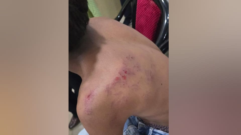 Salesman demanded money for giving petrol without helmet teenagers held hostage and beaten up when protested