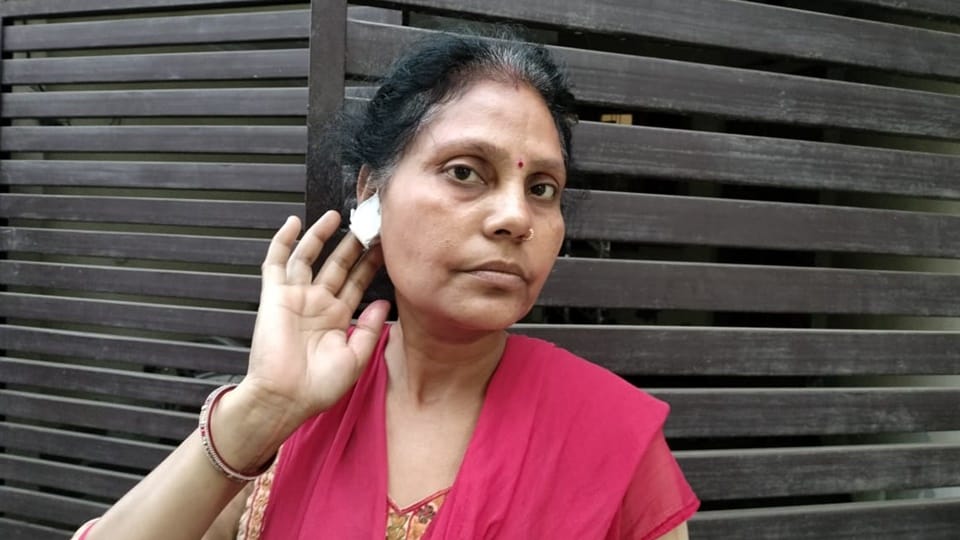 UP: Robbers snatched a woman's earring in Moradabad, she got eight stitches on her ear