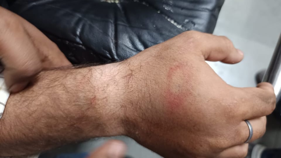 National Youth Award winner beaten by police in police station, seriously injured