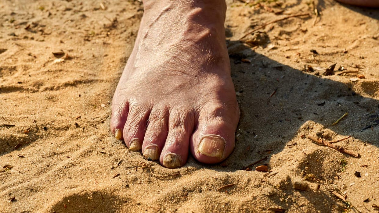tips to remove dark toe knuckles with easy way