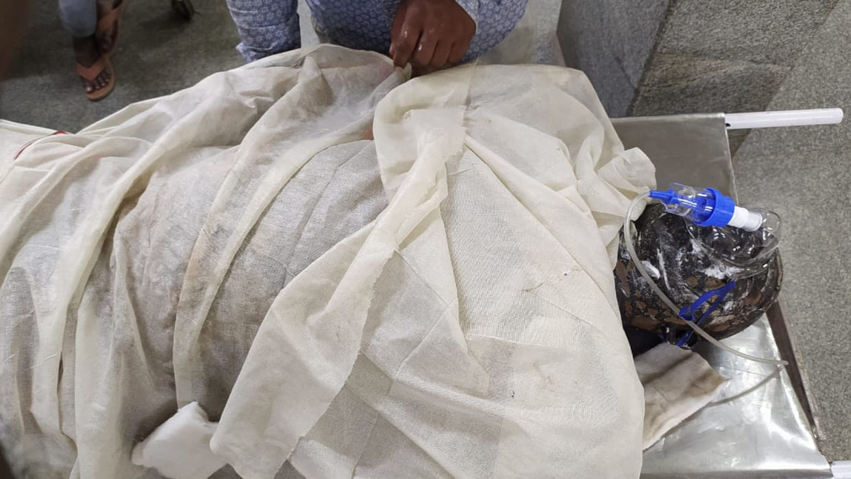 In Gorakhpur. Dairy operator set himself on fire by sprinkling petrol