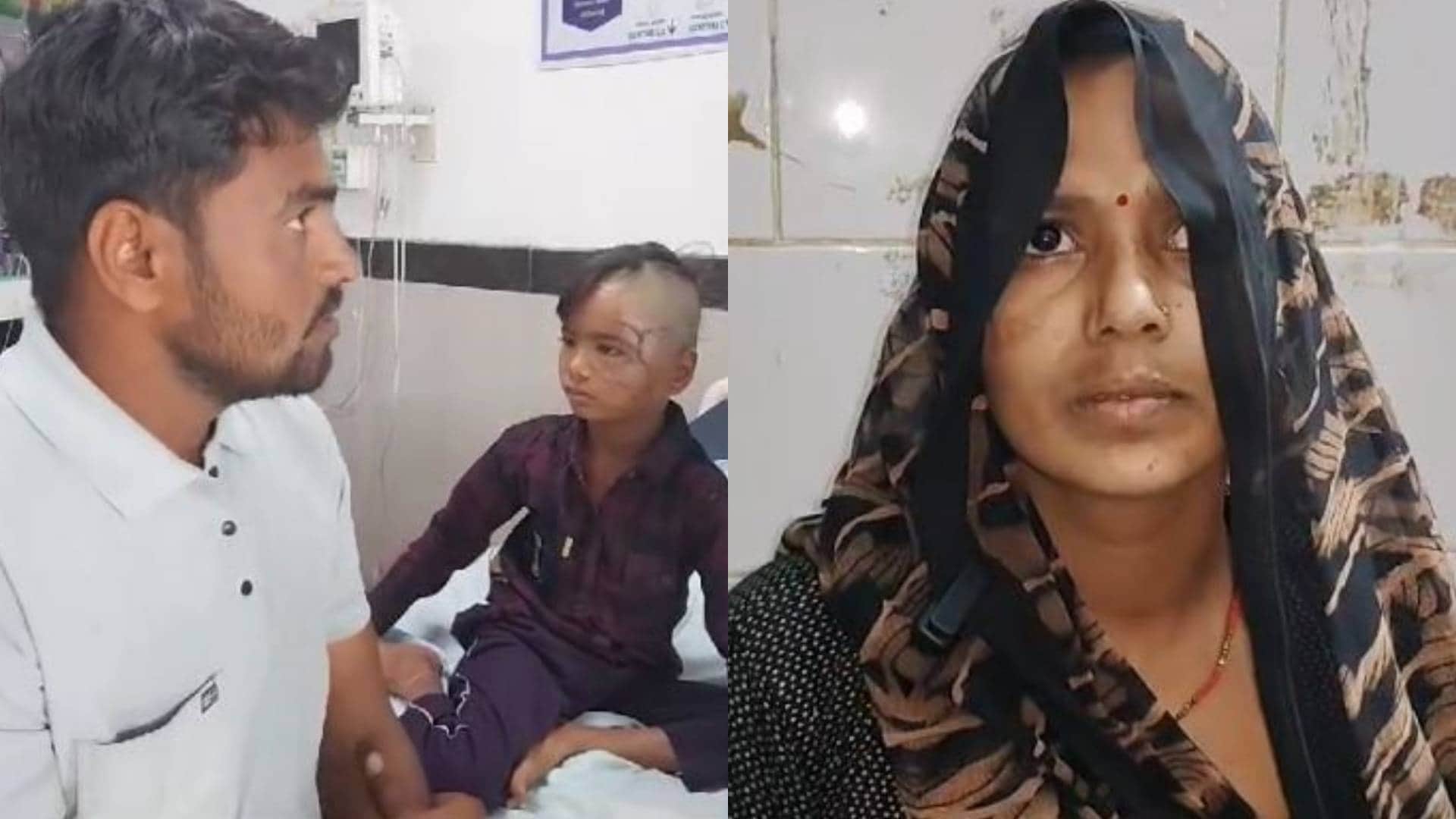 घायल बच्चा और उसकी मां