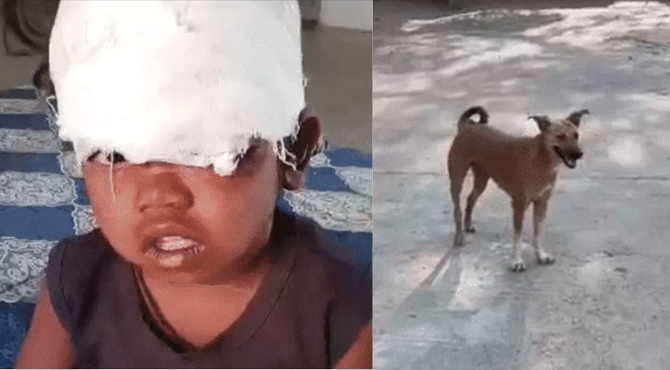 Indore News Baby Attacked by Stray Dogs in Temple Premises, Mother Risks Life to Save Her