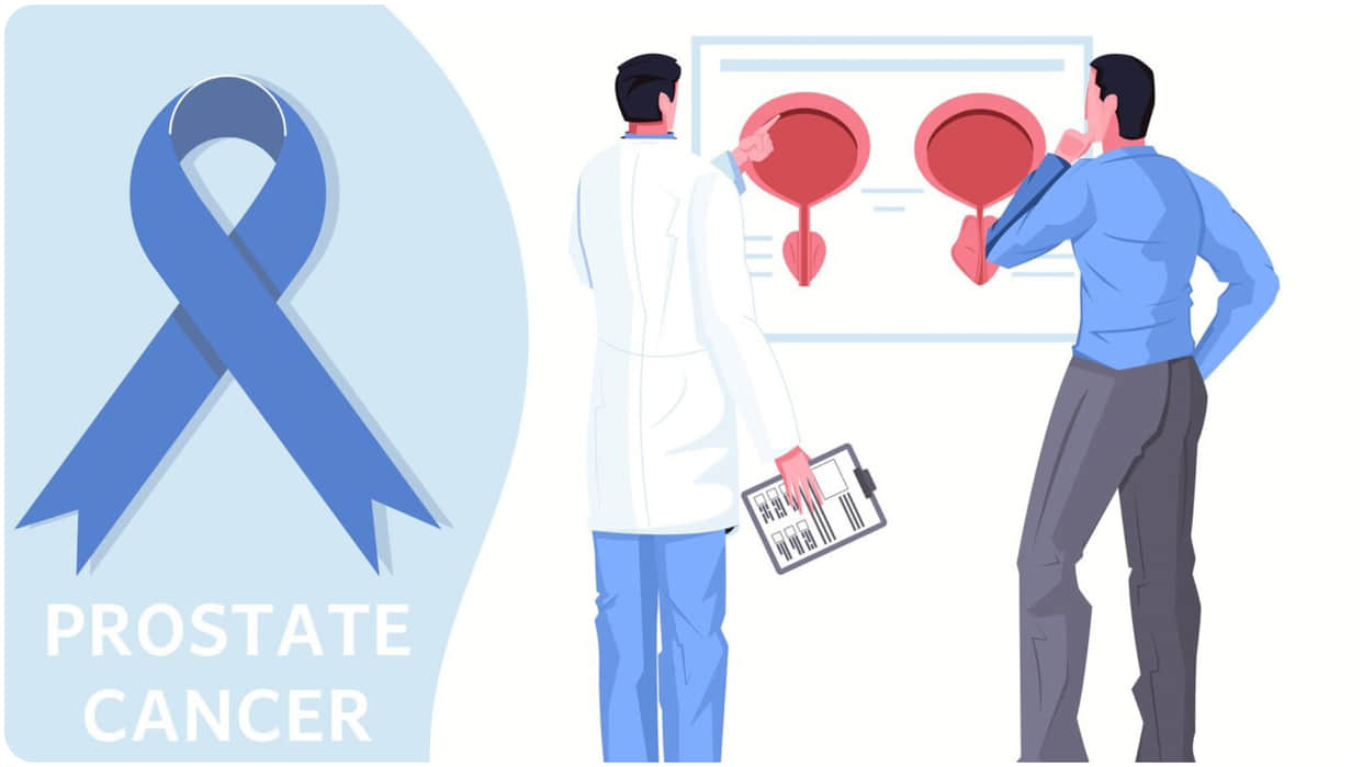 spit test could help diagnose prostate cancer ka kaise pta lagaye