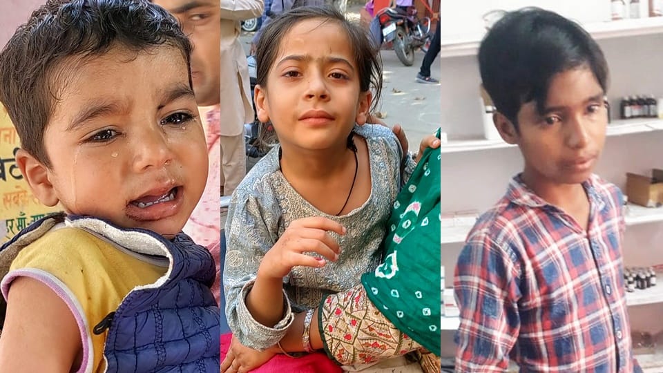 Dogs became dangerous in Moradabad, Ten children were attacked within an hour, two are in critical