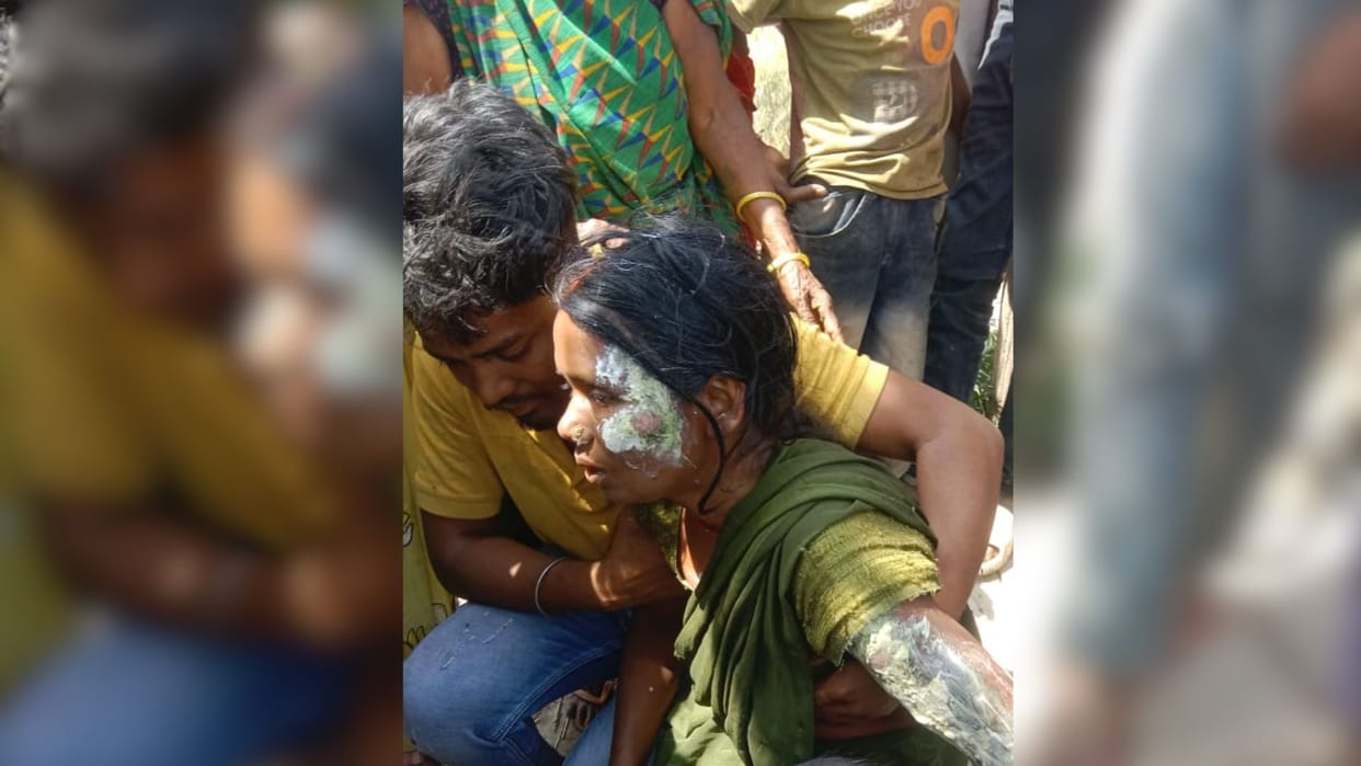 Homes of five families burnt to ashes accident happened due to fire