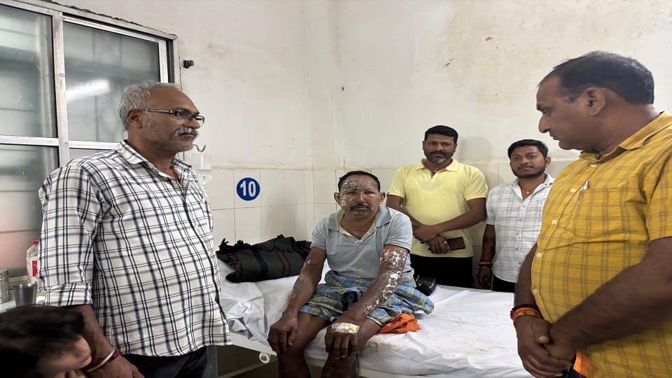 Fire causes loss of Rs 20 lakh villager severely burnt while trying to extinguish it in Balrampur Ramanujganj