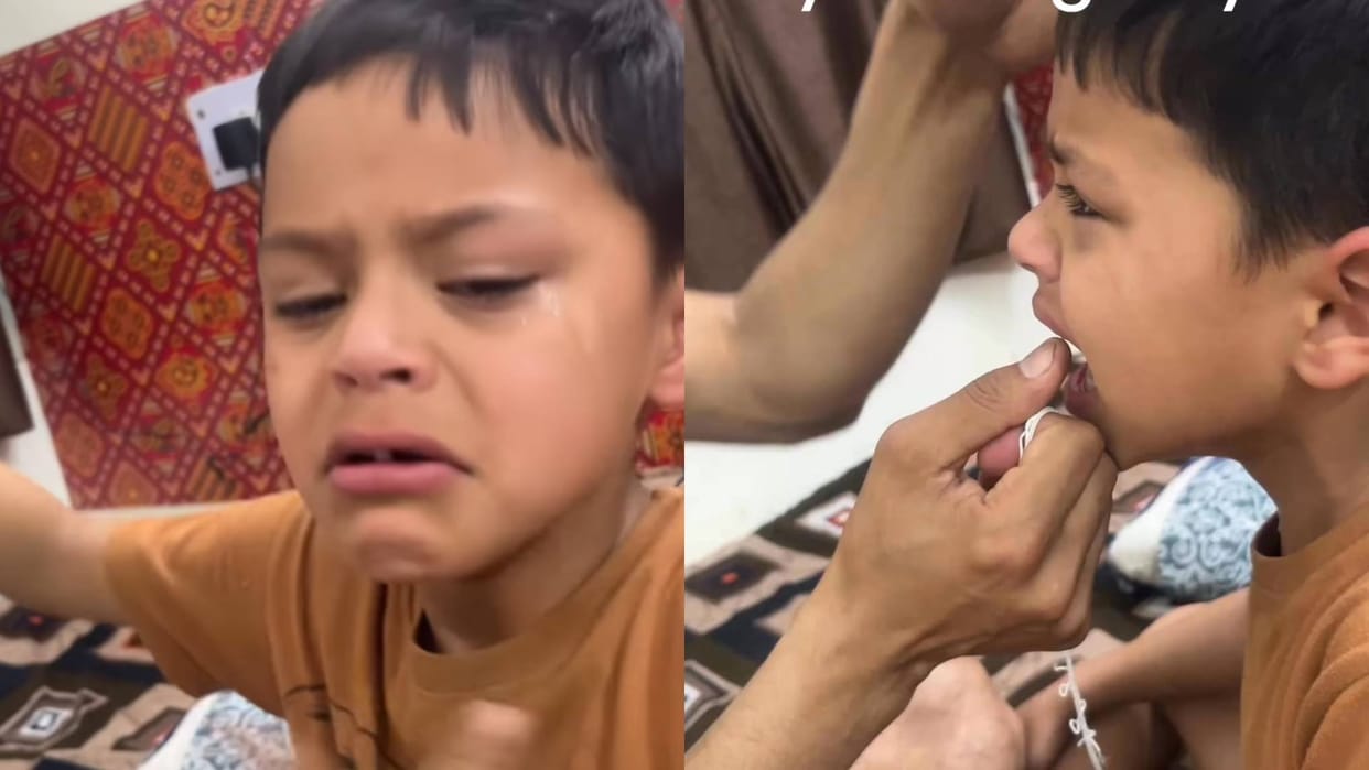 Father took out the son milk tooth with a desi trick Video goes viral on Internet In Hindi
