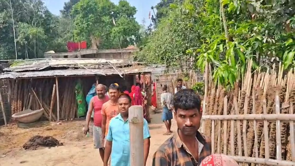 Purnea: Family fled from hospital as soon as alien-like child born, crowd gathered in village to see newborn