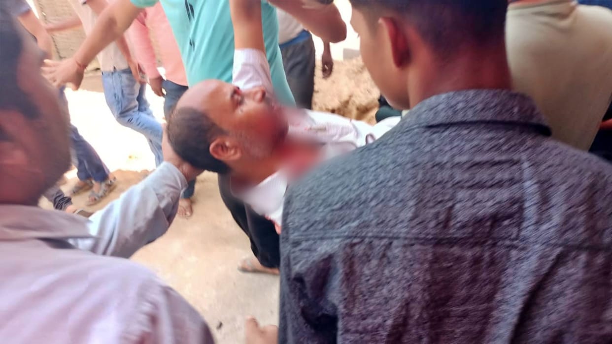 Motihari Crime: Criminals shot hardware businessman in broad daylight, fled while firing; SP formed SIT team