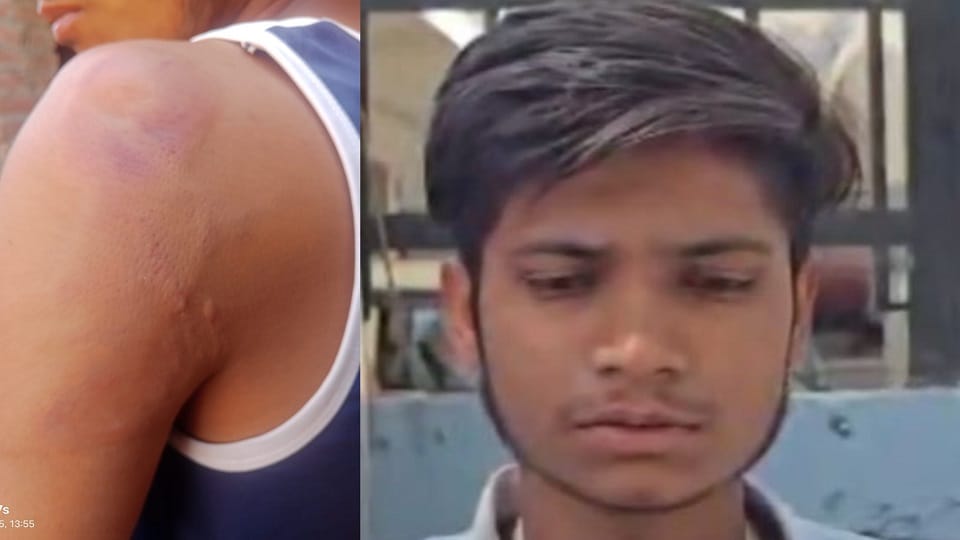 Punishment for drinking water from teacher bottle body beating fingers broken because he is Dalit