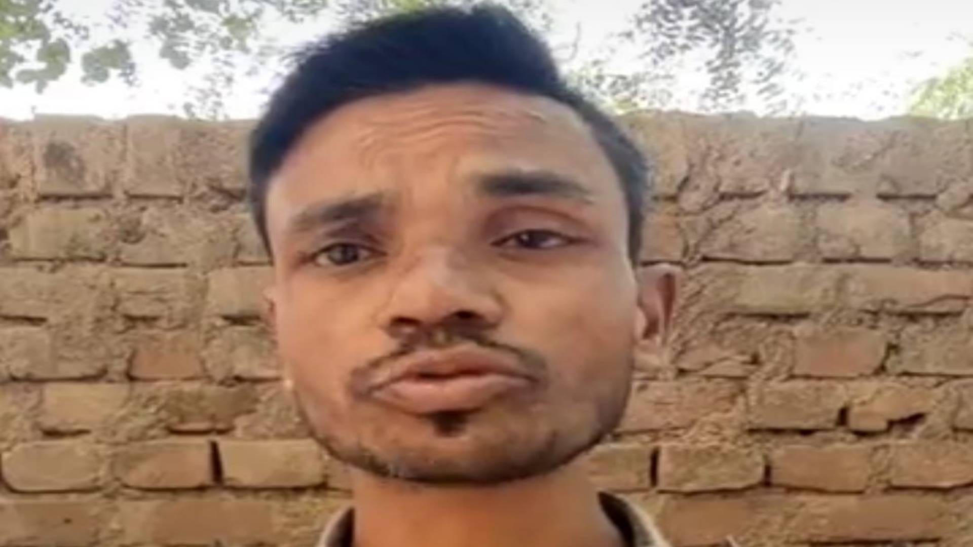पीड़ित नगर निगम कर्मचारी