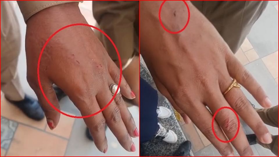 Two women insisted on going on CM Yogi stage bit hand of policemen with their teeth