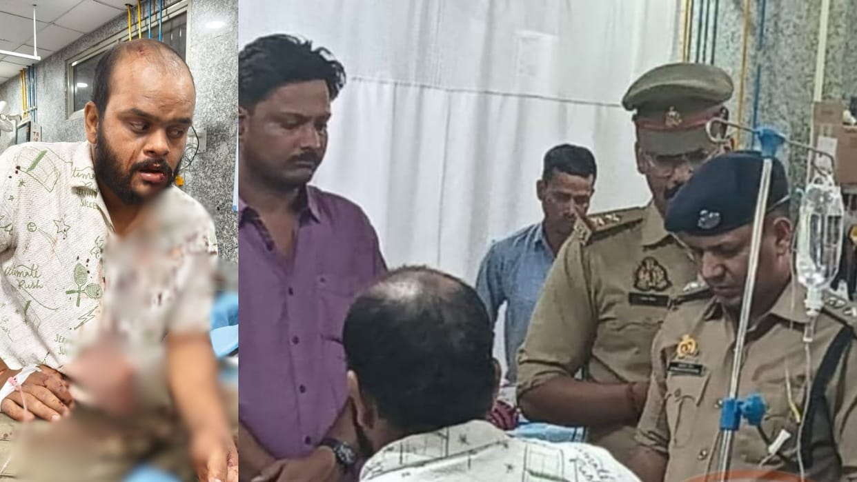 Bullies shot young man in mouth injured man taken to BHU trauma center in varanasi