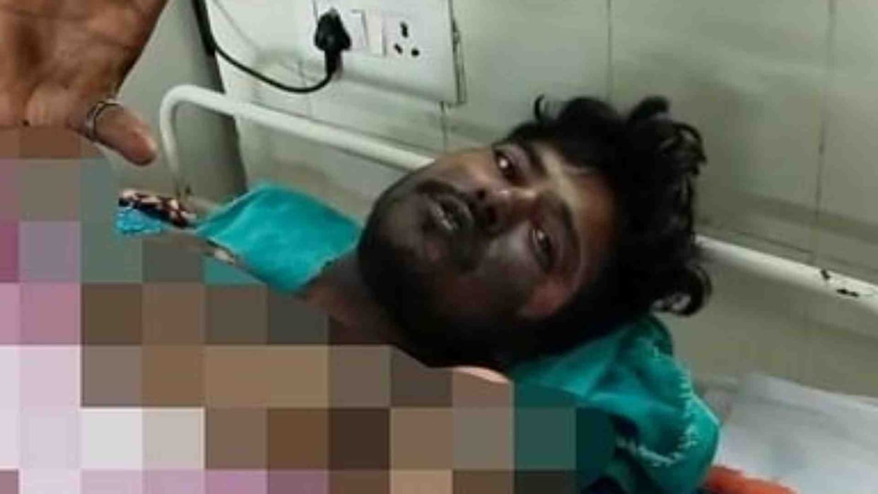 Umaria News: Burnt body of a youth found on railway track