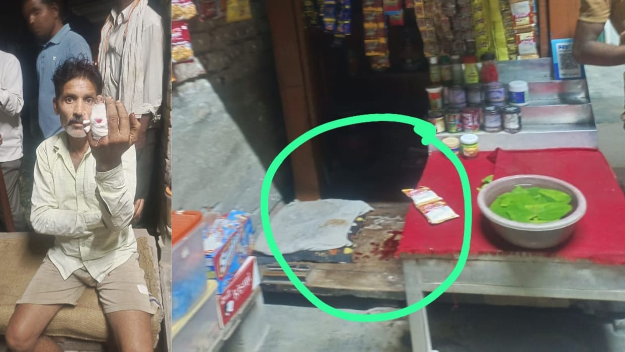 A rowdy bike rider shot a paan vendor he was taken to the hospital, police started investigation