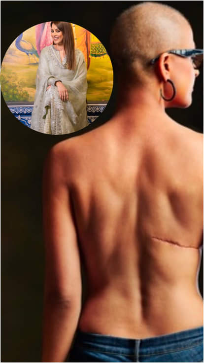 इन अभिनेत्रियों को हुआ ब्रेस्ट कैंसर