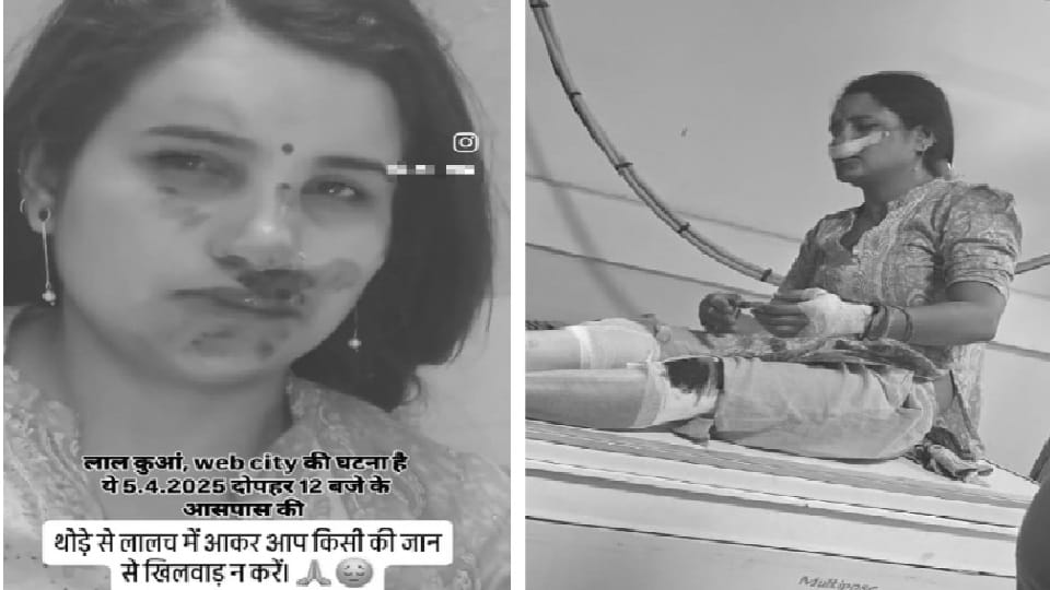 Reel lover woman calls road accident an attempt to rob chain in ghaziabad