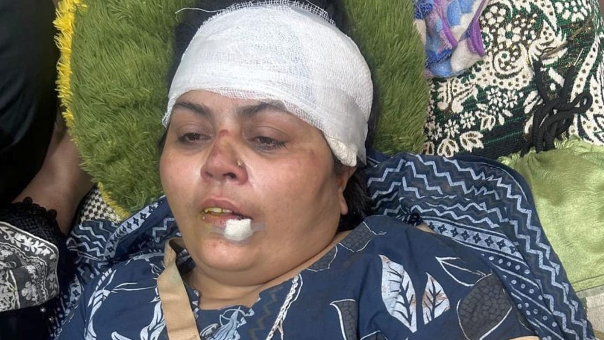 Purse looted in front of Income Tax office woman fell from bike in Bareilly