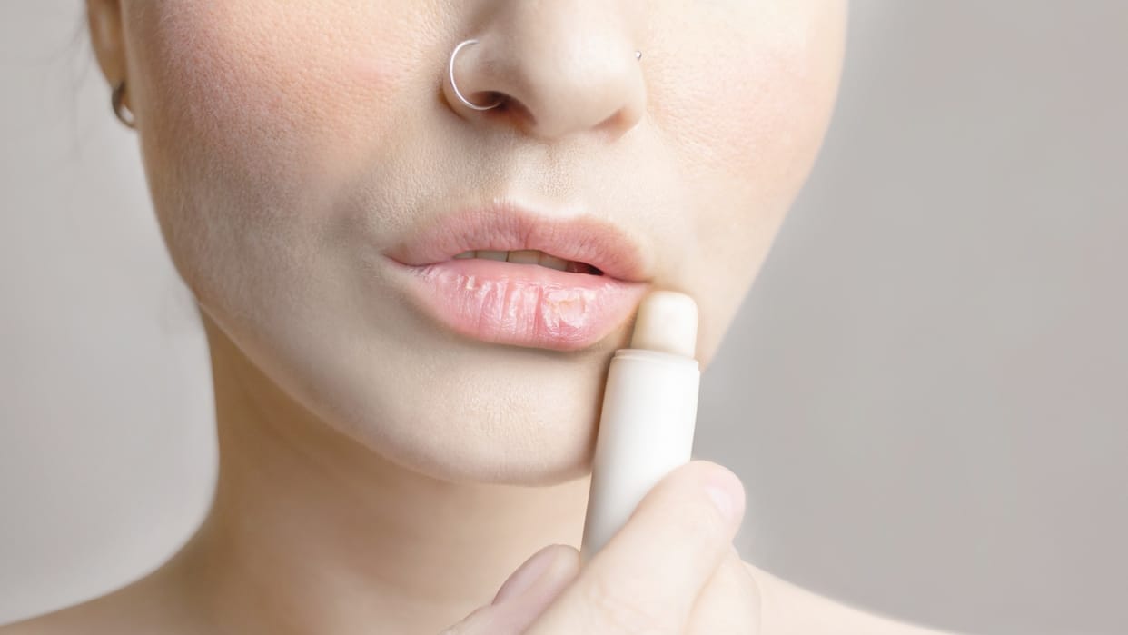 Chapped Lips treatment in hindi garmi me hoth fat jaye to kya kare