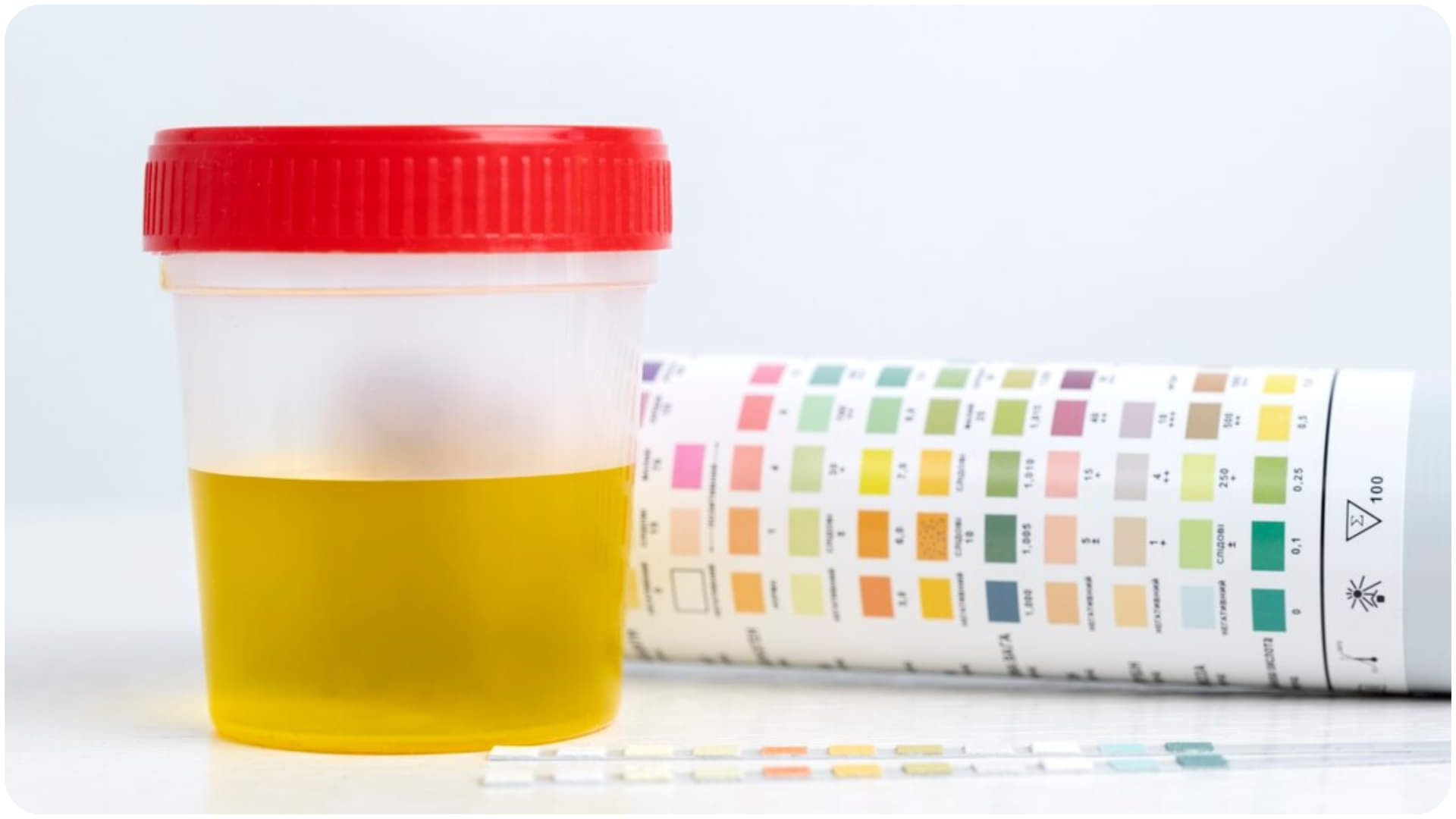 Why Dehydration Increase in Winter Symptoms Identify From Urine Color